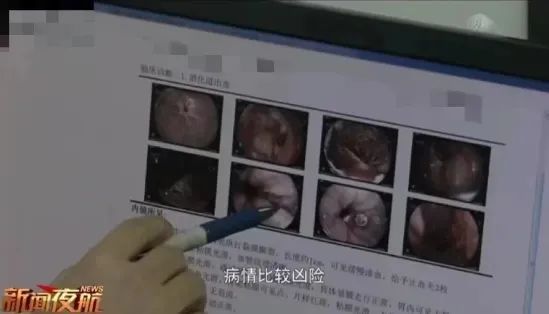 男子一口气喝完冰镇饮料后，吐血1000毫升！医生紧急提醒……