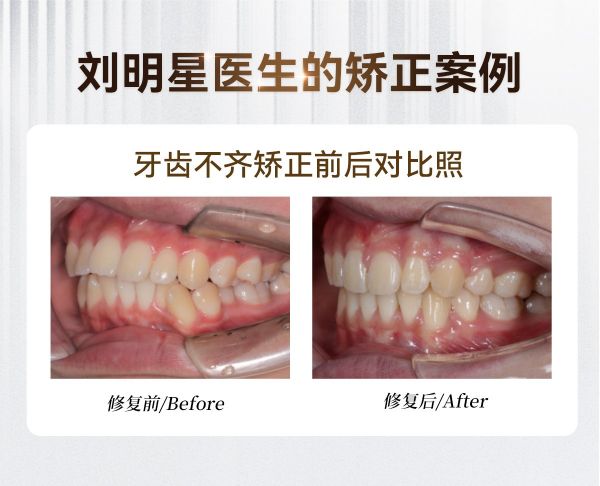 上海正畸医生刘明星:专注牙齿矫正数年，倡导健康整牙