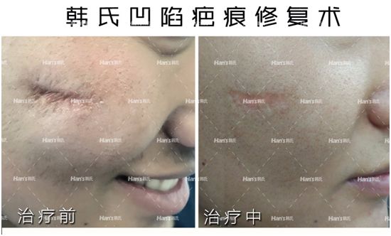 QQ圖片20170927173823.png