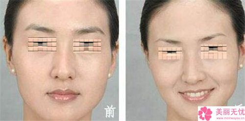 李宇飞纹眉纹眼线持续多久时间