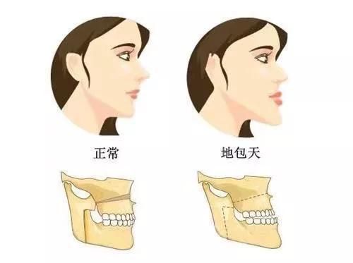 來(lái)源丨百度