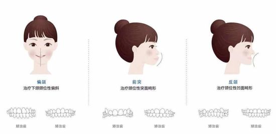 來(lái)源丨知乎