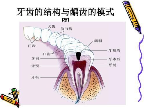 牙齒敏感酸的冷的都不敢吃怎么辦？試試這些家庭療法，有用