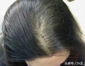 番石榴葉不但是脫發(fā)救星，癌細(xì)胞、膽固醇都不是它的對手！