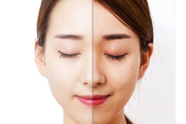 什么牌子美白去黃效果最好 2024美白效果好的護膚品排名 皮膚黃怎么調(diào)理