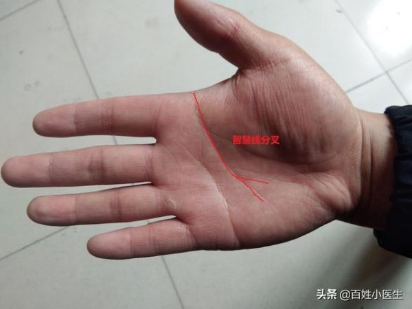 智慧線在手診中的作用，4種不同變化代表不同健康狀況，值得收藏