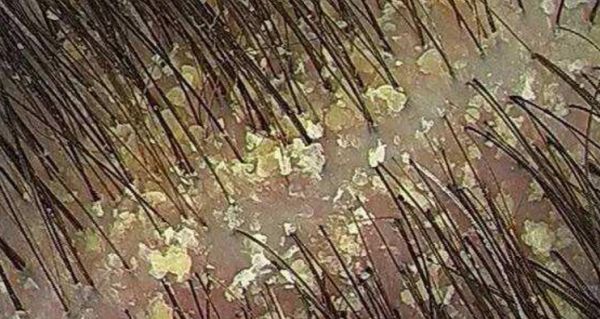 春雨醫(yī)生