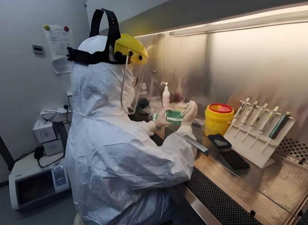 艾滋核酸檢測(cè)