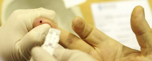 艾滋病试纸 艾滋病试纸准吗 艾滋病试纸检测