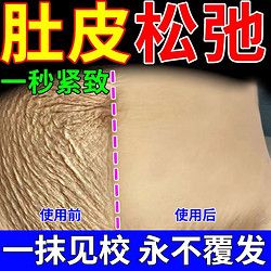 產(chǎn)后肚皮松弛緊致霜緊致乳強(qiáng)力收腹緊致肚皮松弛修復(fù)產(chǎn)后肚皮松弛