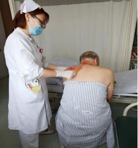 刮痧.png