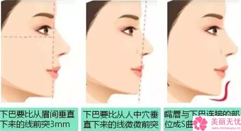 鶴崗硅膠墊下巴整形手術(shù)的費(fèi)用一般要多少
