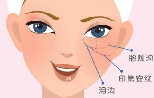 石家莊填充淚溝醫(yī)院排名推薦:美聯(lián)臣整|美萊|天宏成功上榜