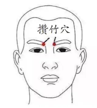 「健康中国」多数头痛竟是因为它!对照头痛部位表,轻松缓解