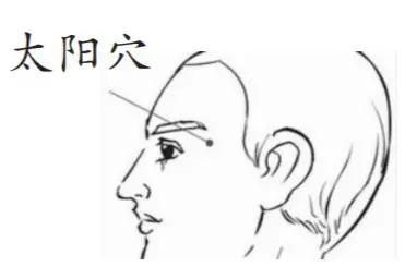 「健康中国」多数头痛竟是因为它!对照头痛部位表,轻松缓解