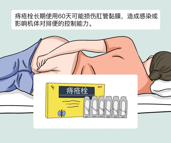痔瘡栓長期使用60天有什么危害.jpg