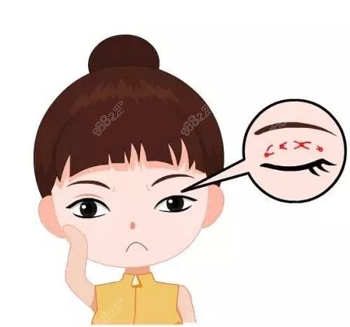 國內(nèi)正規(guī)修復(fù)雙眼皮醫(yī)院排名,北京/上海/大連聯(lián)合麗格上榜