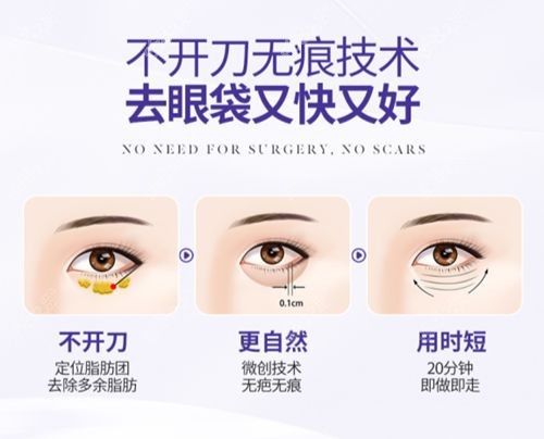 健麗醫(yī)美去眼袋是真的,真實經(jīng)歷驗證健麗去眼袋有效不假