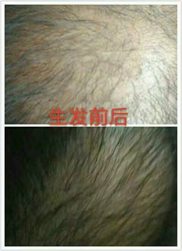 黑龍江染發(fā)品牌排行榜，打造個性化時尚造型，盡在掌握