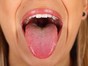 韓式雙眼皮手術(shù)