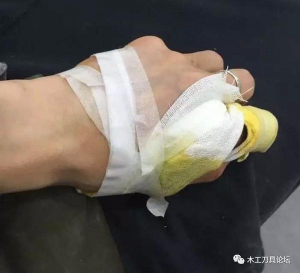 木工安全锯切技术：凡是使用过台锯的绝大多数都有锯齿反弹经历
