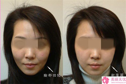 天津愛(ài)麗諾醫(yī)療美容醫(yī)院面部溶脂手術(shù)醫(yī)生哪位好