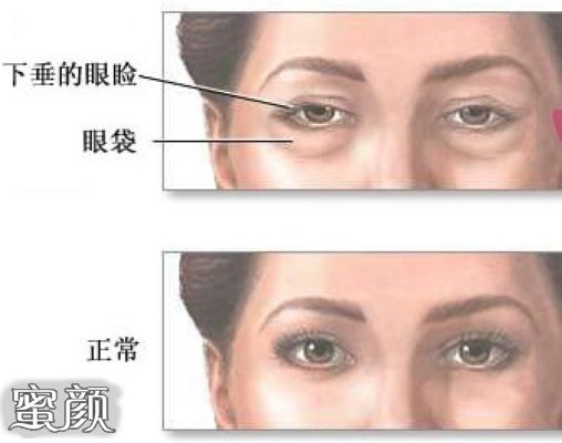 https://img.miyanlife.com/mnt/Editor/2020-09-14/5f5f732359951.jpg