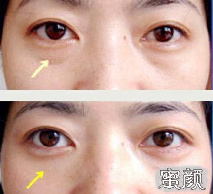 https://img.miyanlife.com/mnt/Editor/2020-09-14/5f5f732eac44f.jpg