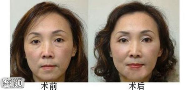 https://img.miyanlife.com/mnt/Editor/2020-09-14/5f5f733d91778.jpg