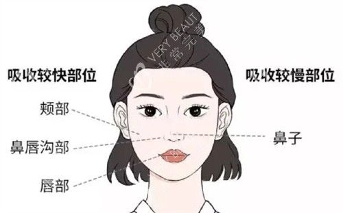 饅化臉修復(fù)方法