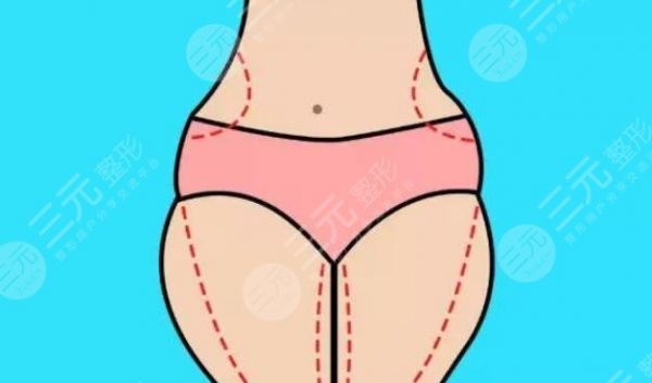 溶脂