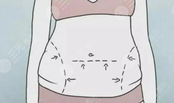 溶脂