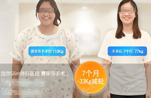 韓國(guó)首爾SLIM外科醫(yī)院成功實(shí)例