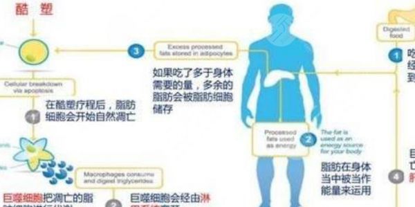 酷塑冷凍減脂