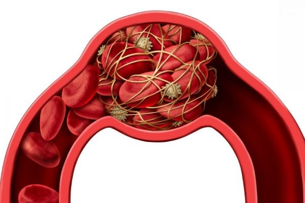 2型糖尿病會死嗎 2型糖尿病人的最終下場 2型糖尿病最終命運