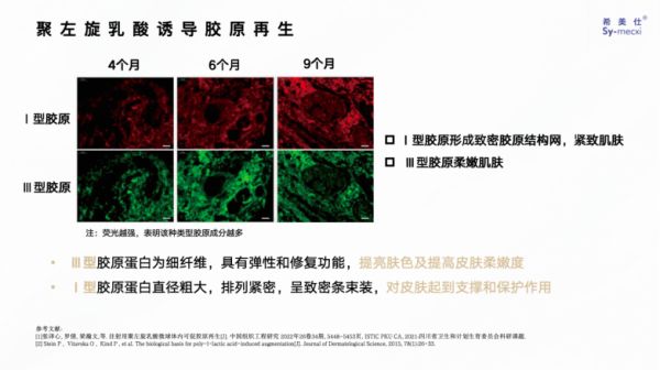 【科普】童颜针聚左旋乳酸PLLA用在面部抗衰的安全性如何？