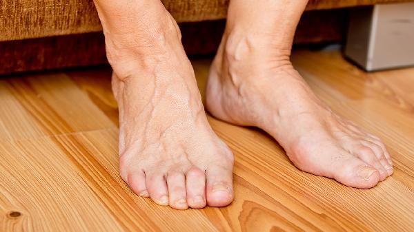 怎样选择瘦身霜可以让我们瘦的更快?