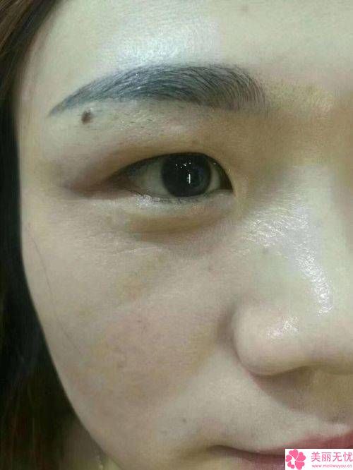 懷化市名次靠前的注射針功夫除皺醫(yī)院(懷化美蒂珂整形醫(yī)療美容是醫(yī)美健康守護者)