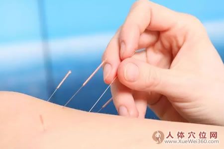 一次讀懂：牙痛、咽喉痛、頭痛針灸取穴穴位！