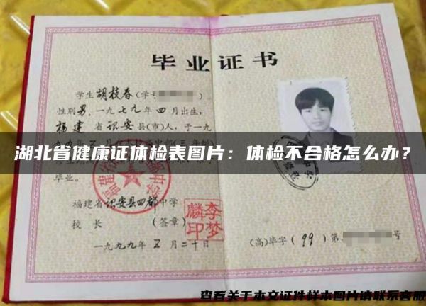 湖北省健康证体检表图片：体检不合格怎么办？