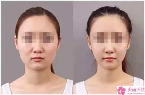 蚌埠市瘦脸针瘦脸手术医院排行前十名值得观望（蚌埠市瘦脸针瘦脸手术整形医院）