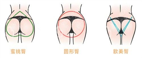 多種臀部形態(tài)素材圖片