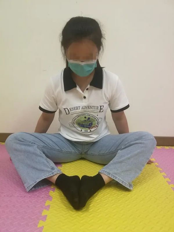 孩子是「X 型腿」？先別慌！簡(jiǎn)單幾招就可以改善