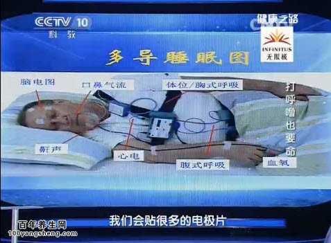 睡眠检测的项目