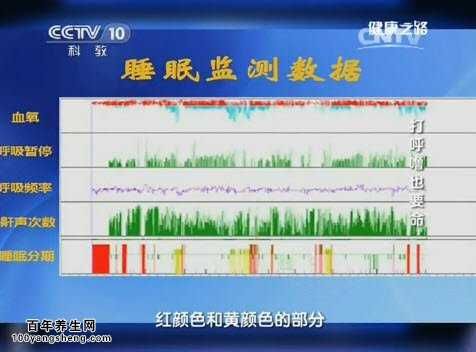 睡眠检测数据图