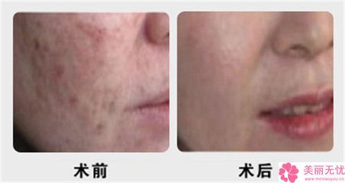 丽水市哪家针灸拔罐减肥医院好-丽水黄君曼医疗美容诊所优质医美价格公道