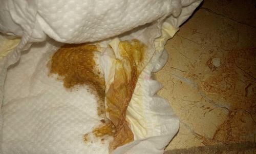 如何判斷狗狗的便便是否正常（從形狀、顏色、氣味等方面看狗狗的健康狀況）