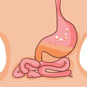 腸道不好怎么辦？恢復(fù)腸道健康這樣做！