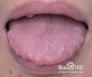 如何通過舌頭分辨健康狀況_健康的舌頭是怎樣的？舌頭有這3個(gè)表現(xiàn)，身體也好不到哪去
