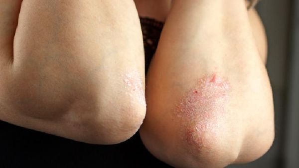 如何有效瘦手臂？按摩哪些穴位能瘦手臂？